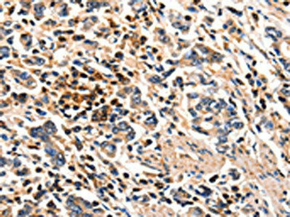 FOXB2 Antibody PACO17881