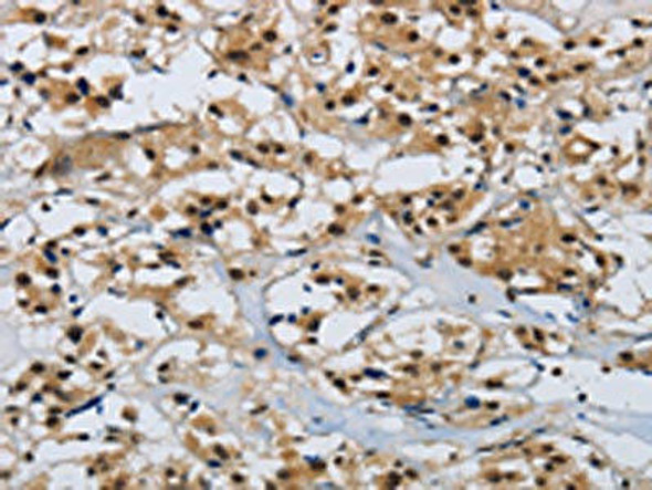 CMTM8 Antibody PACO17945