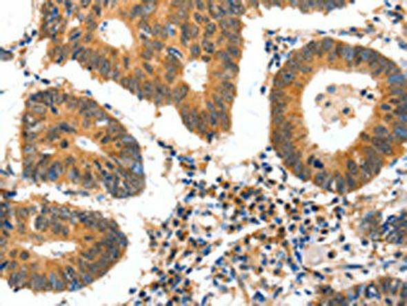 GDF6 Antibody PACO17979