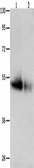 GDF6 Antibody PACO17979