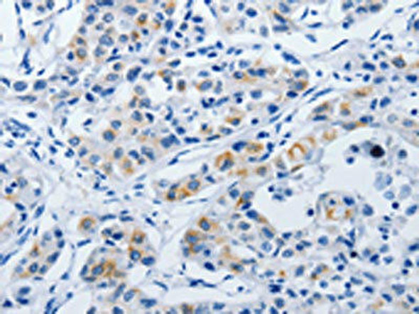 BPIFB3 Antibody PACO18162
