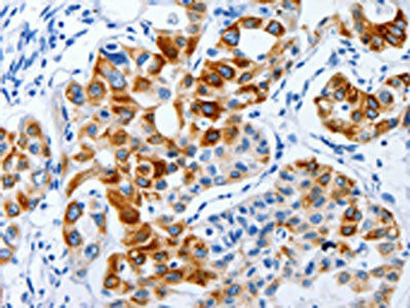 BPIFB3 Antibody PACO18163