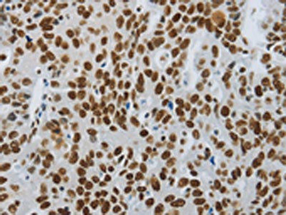 SLC16A14 Antibody PACO18202
