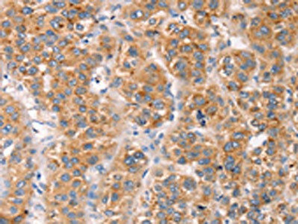 MLNR Antibody PACO18253