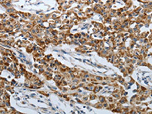 SPAG1 Antibody PACO18424