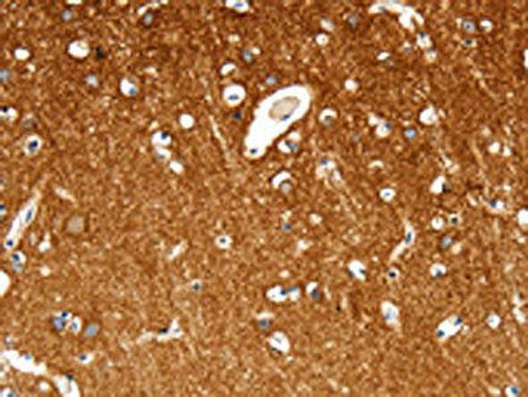 MAP4K1 Antibody PACO18445