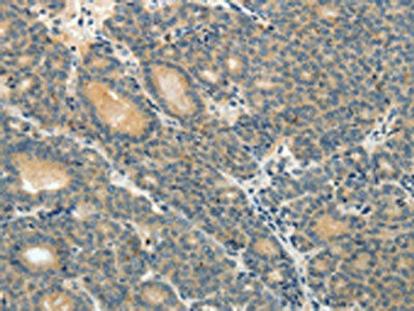 ABCC12 Antibody PACO18497