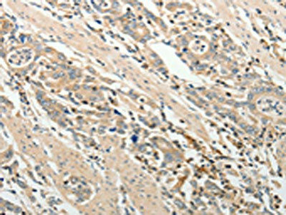 ADAMTS2 Antibody PACO18515