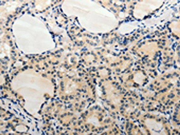 ADAMTS6 Antibody PACO18516
