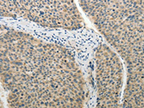 ADHFE1 Antibody PACO18521