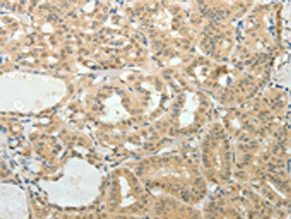 AFF2 Antibody PACO18526