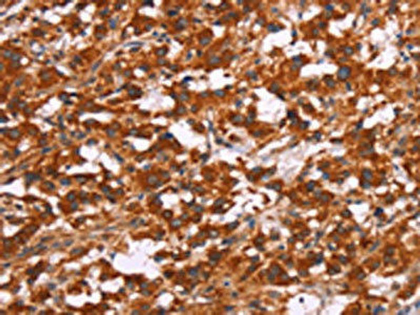 ARPC4 Antibody PACO18584