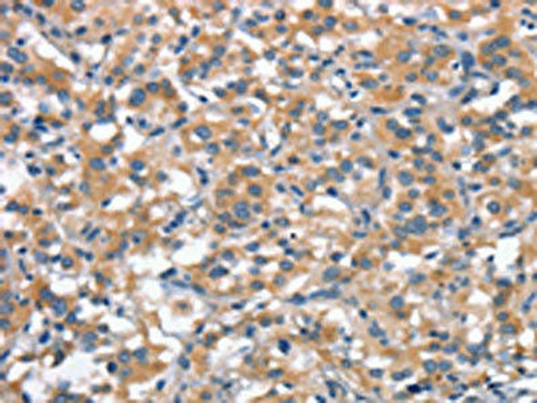 ANP32C Antibody PACO18652