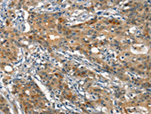 ANP32C Antibody PACO18653