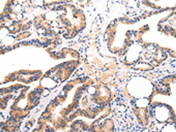 IGLV1-51 Antibody PACO18709