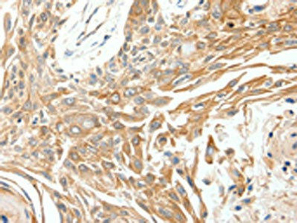 SCN11A Antibody PACO18878