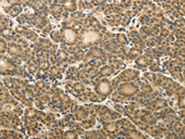 MAP1A Antibody PACO18950