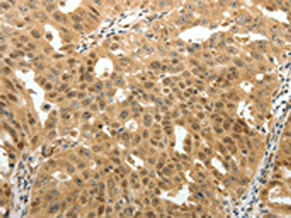 MAP1A Antibody PACO18951