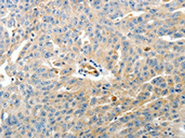 CD93 Antibody PACO18979