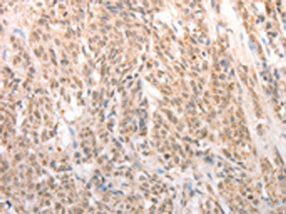 ACIN1 Antibody PACO19043