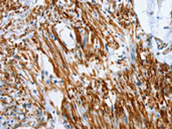 SHROOM2 Antibody PACO19129