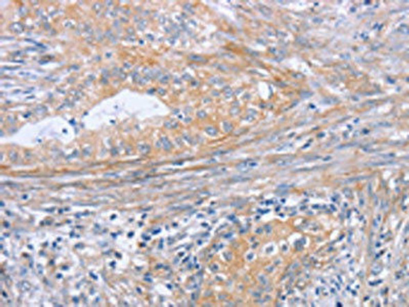 BOD1 Antibody PACO19358