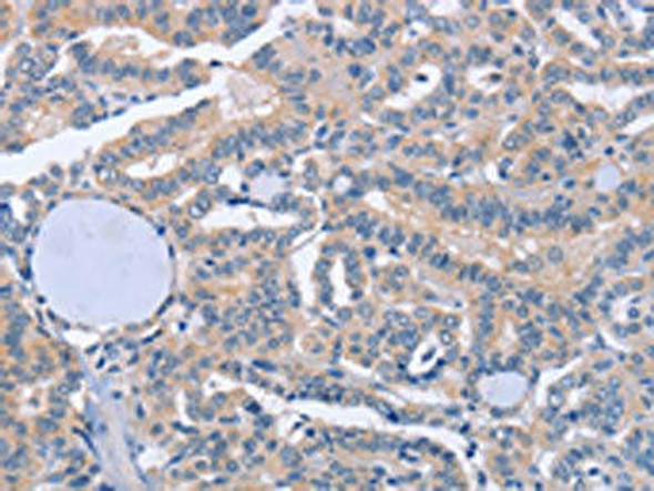 BOD1 Antibody PACO19359