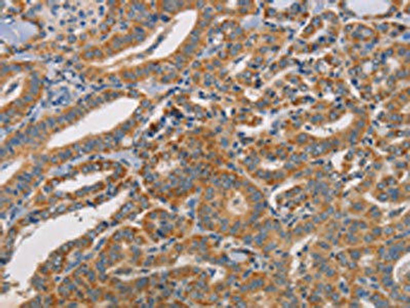 CDK11A/CDK11B Antibody PACO19446
