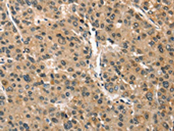 CRIM1 Antibody PACO19511