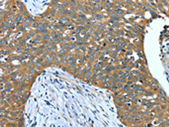 DTX1 Antibody PACO19562