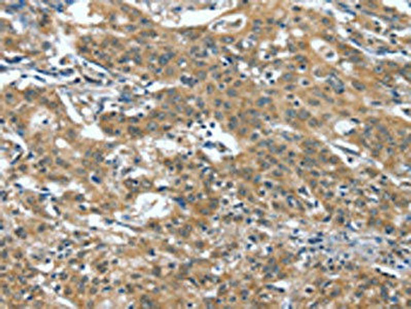 DTX1 Antibody PACO19562