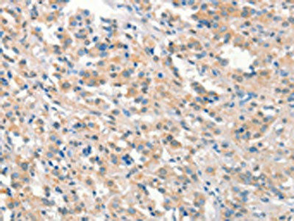 KCNB1 Antibody PACO19583