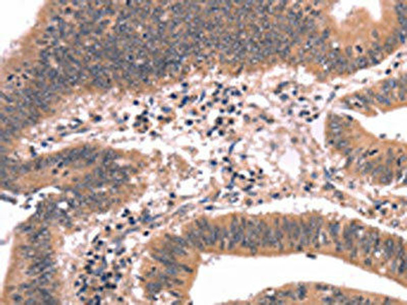 FGF22 Antibody PACO19658