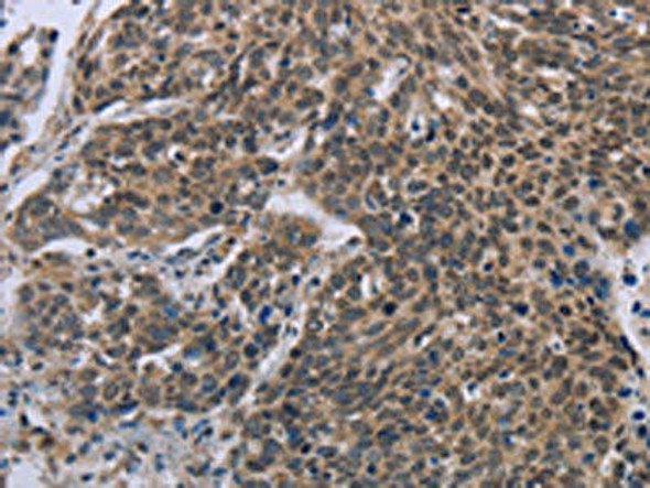 FGF20 Antibody PACO19660