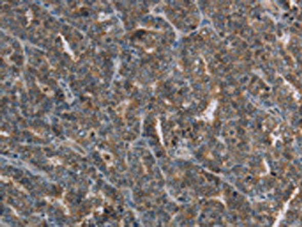 FGF20 Antibody PACO19660