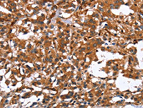 GPHN Antibody PACO19701