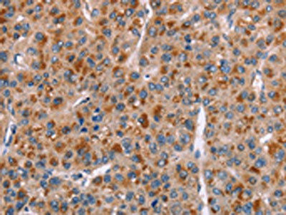 GPHN Antibody PACO19701