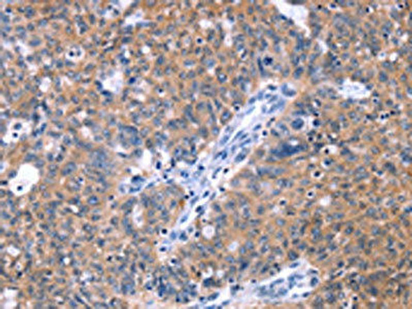 ZNF395 Antibody PACO19749