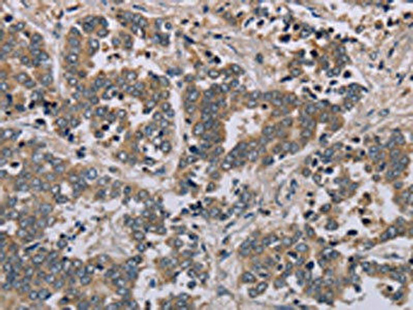 AATK Antibody PACO20089