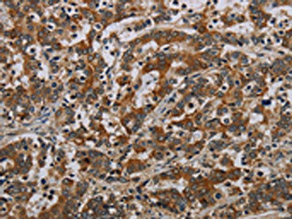 NLRP9 Antibody PACO20105