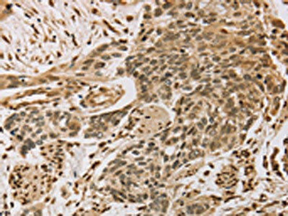 CENPV Antibody PACO20280