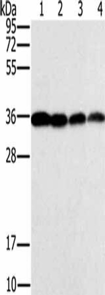 CENPV Antibody PACO20281