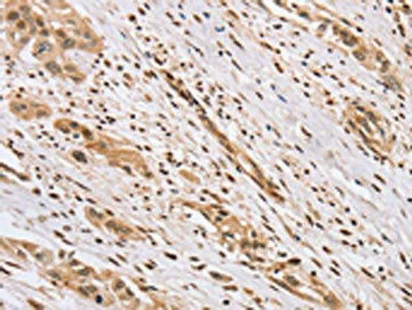 CENPV Antibody PACO20281