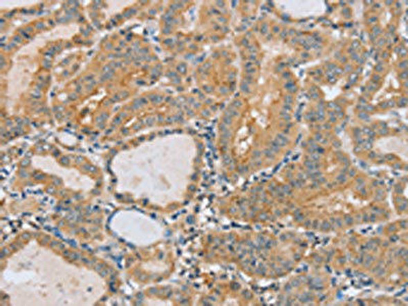 PTPN4 Antibody PACO20294