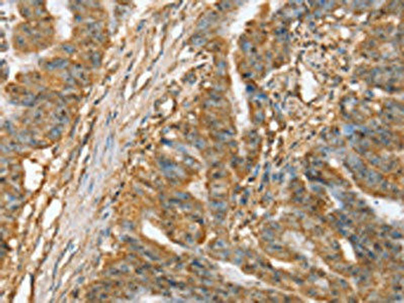 SLC41A2 Antibody PACO20510