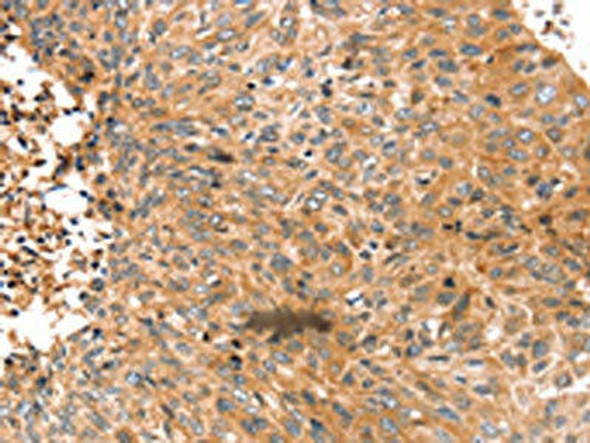 ABCC9 Antibody PACO20628