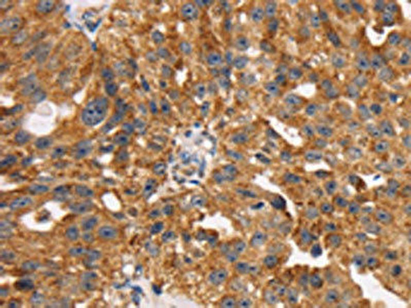 TM4SF1 Antibody PACO20646