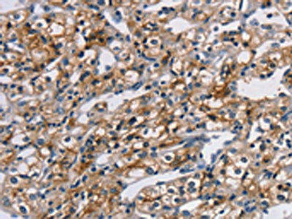 TM4SF1 Antibody PACO20647