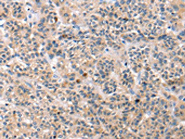 TCERG1L Antibody PACO20667