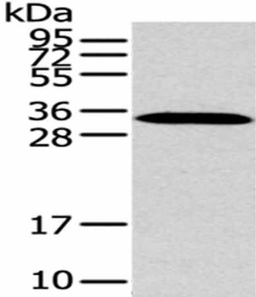 MSI1 Antibody PACO20823